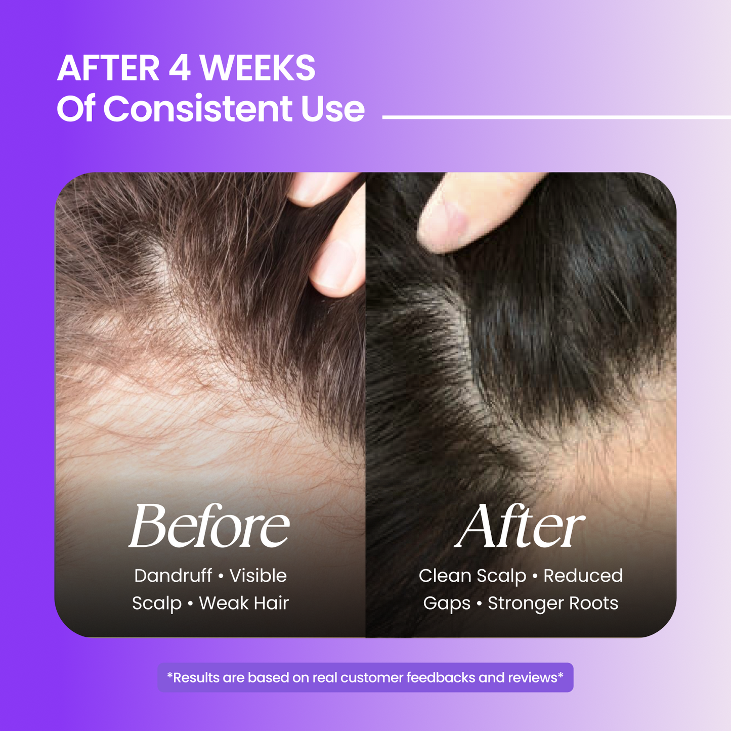 Hair Care Kit(Hair Oil + Shampoo + Conditioner)