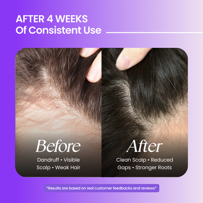 Hair Care Kit(Hair Oil + Shampoo + Conditioner)