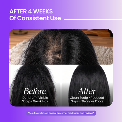 Shampoo + Conditioner (200 ml + 200 ml)