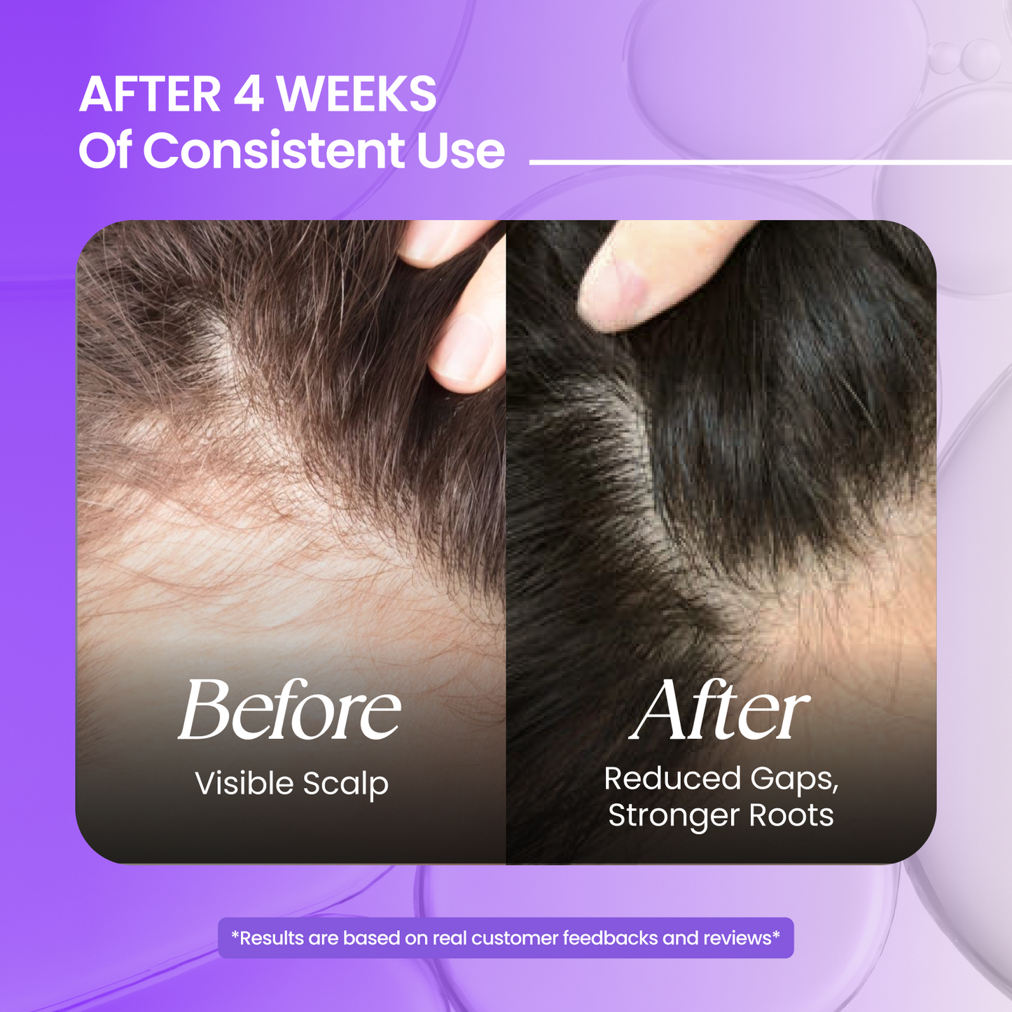 Rosemary Premium Hair Oil