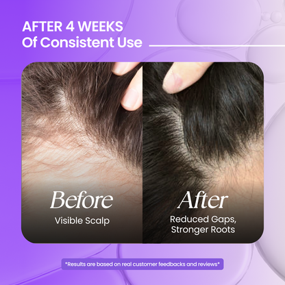 Rosemary Premium Hair Oil