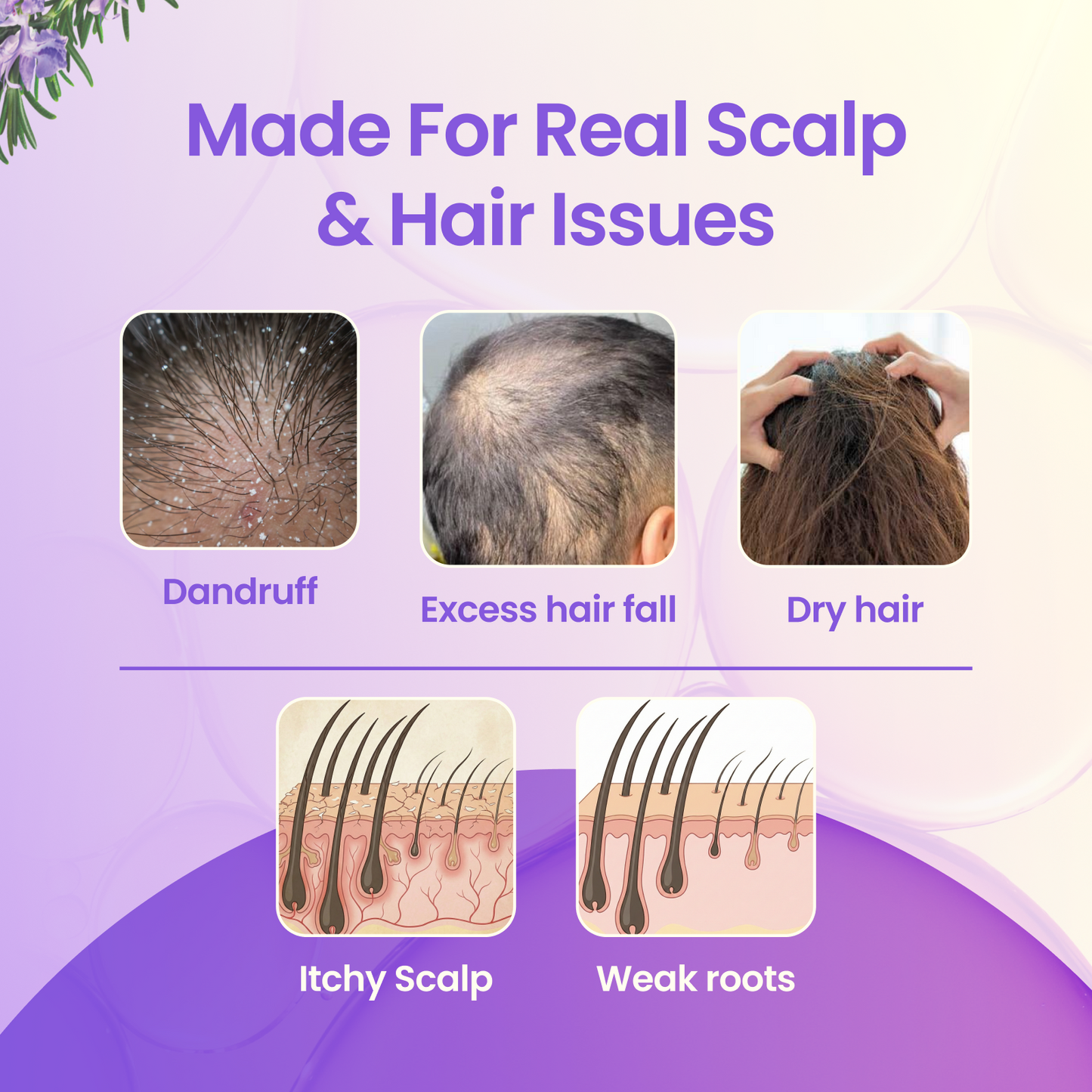 Hair Care Kit(Hair Oil + Shampoo + Conditioner)