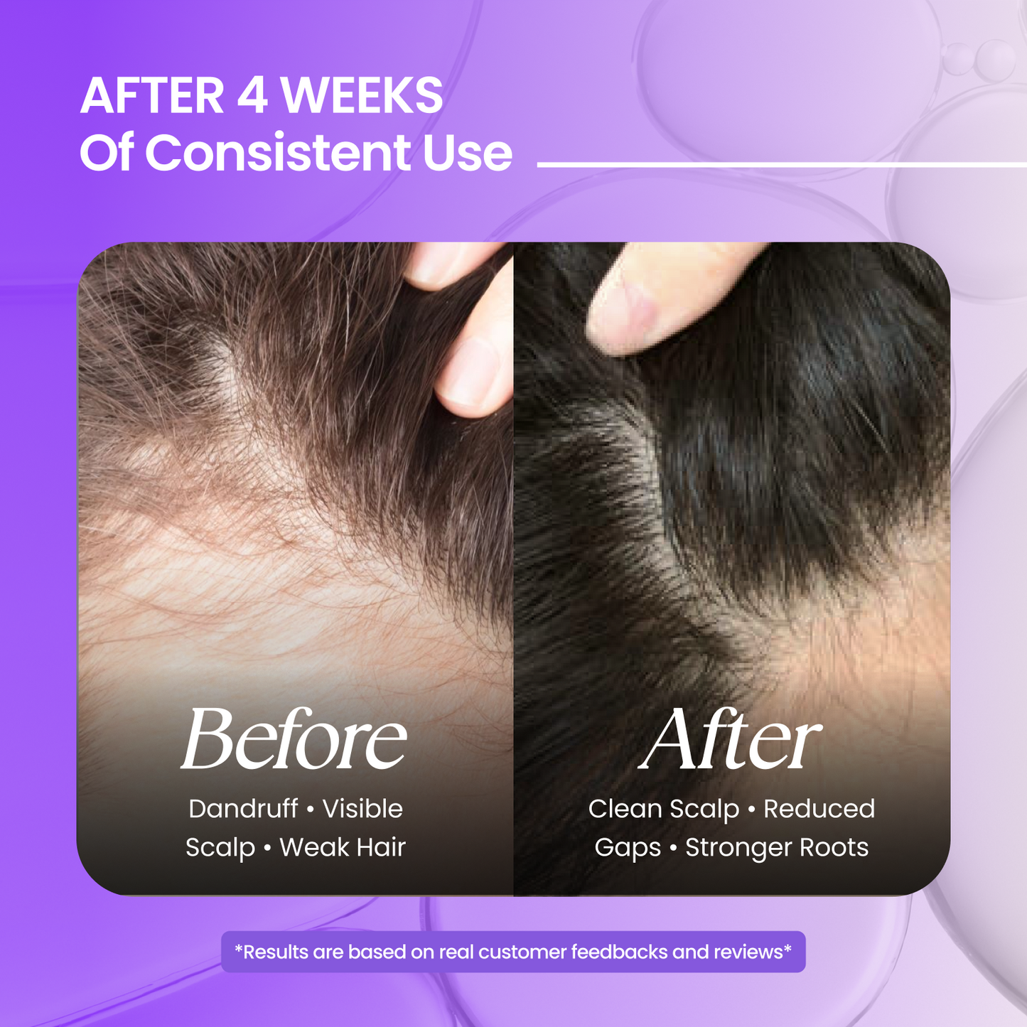 Hair Oil + Shampoo (200 ml + 200 ml)