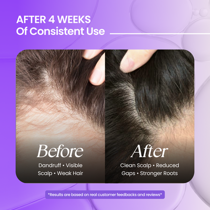 Hair Oil + Shampoo (200 ml + 200 ml)