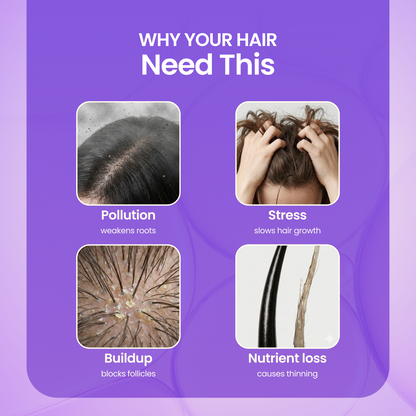 Rosemary Hair Growth Spray - 100 ml