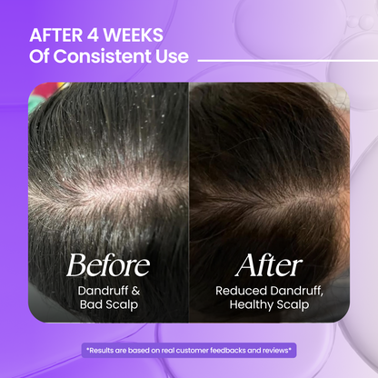 Tea Tree Shampoo - 200 ml