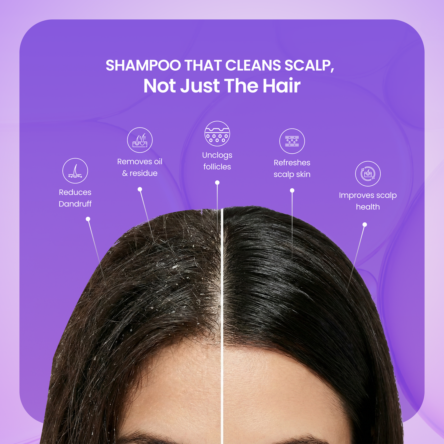 Tea Tree Shampoo - 200 ml