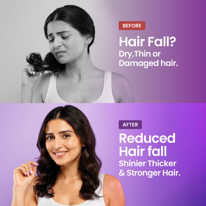 Rosemary Hair Growth Spray